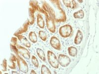 Formalin-fixed, paraffin embedded rat colon sections stained with 100 ul anti-Beta Catenin (clone CTNNB1/1507) at 1:50. HIER epitope retrieval prior to staining was performed in 10mM Tris 1mM EDTA, pH 9.0.